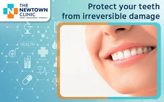 Protect your teeth from irreversible damage