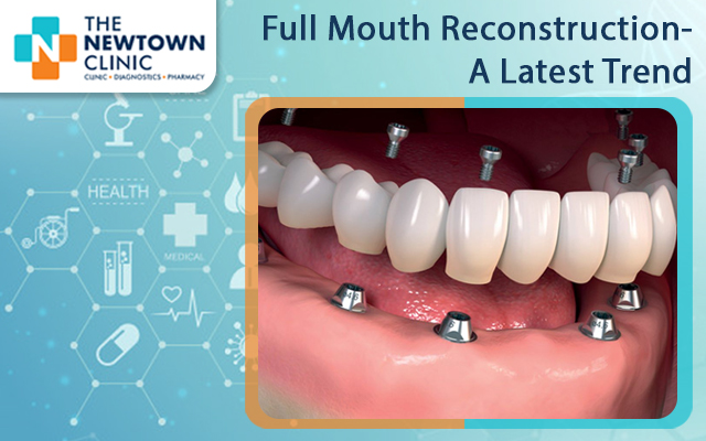 Full Mouth Reconstruction- A Latest Trend