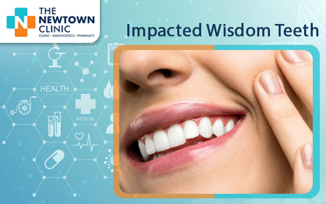 Impacted Wisdom Teeth