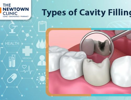 Types of Cavity Fillings Done at the Best Dental Clinic
