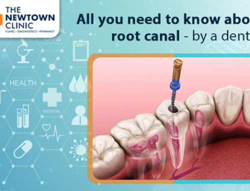 All you need to know about root canal- by a dentist