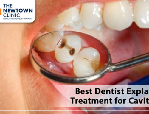Best Dentist Explains Treatment for Cavities