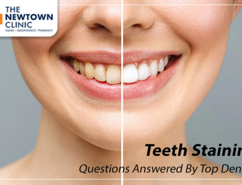 Teeth Staining Questions Answered By Top Dentist