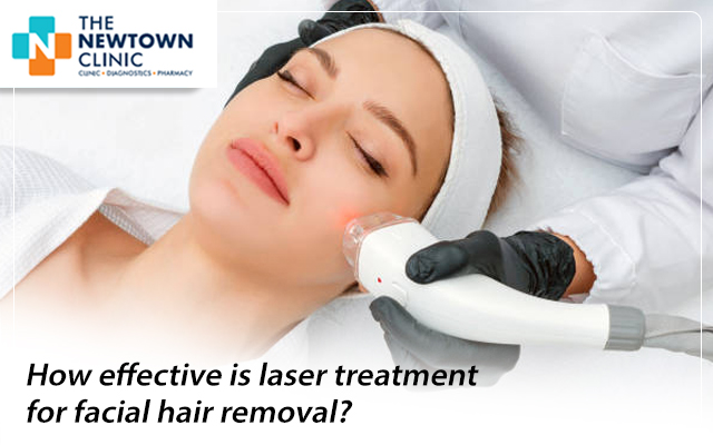 How effective is laser treatment for facial hair removal?