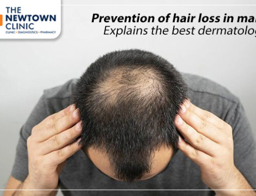 Prevention of hair loss in males: Explains the best dermatologist