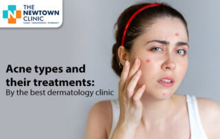 acne treatment in newtown