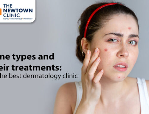 Acne types and their treatments: By the best dermatology clinic