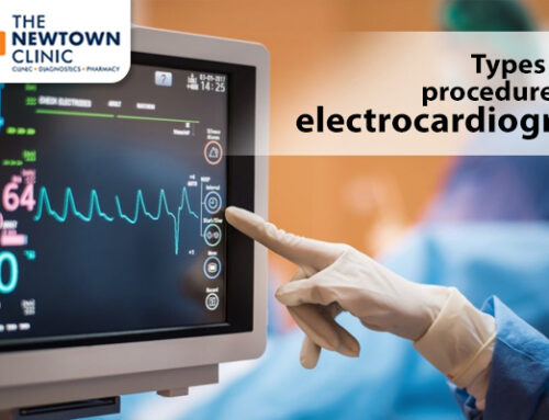 Types and procedures of electrocardiogram