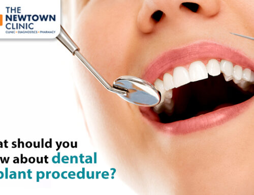 What should you know about dental implant procedure?