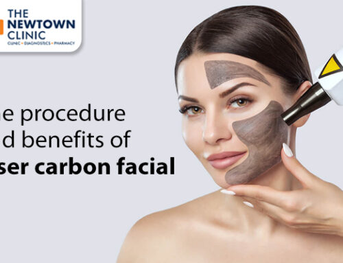 Laser Carbon Facial: Procedure & Benefits