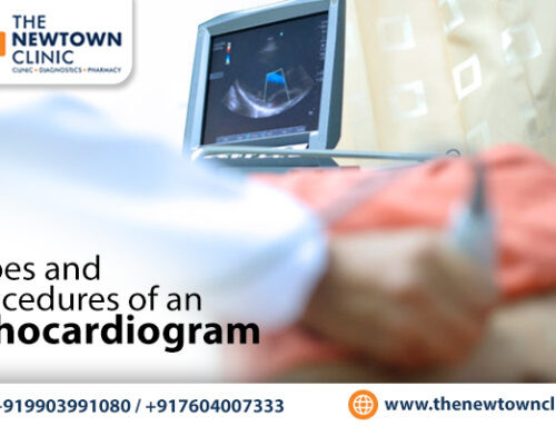 Types and Procedures of an Echocardiogram