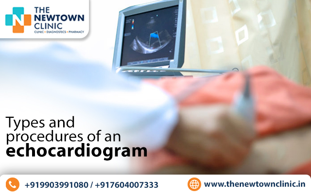 cardiologist says procedure of echocardiogram
