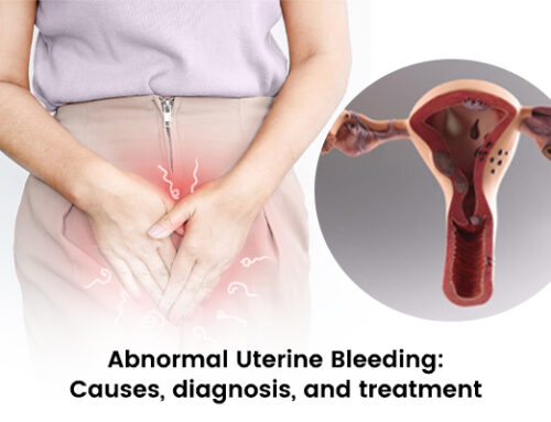 Abnormal Uterine Bleeding: Causes, Diagnosis, and Treatment