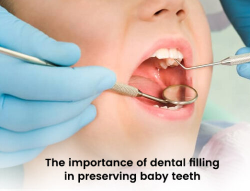 The Importance of Dental Filling in Preserving Baby Teeth