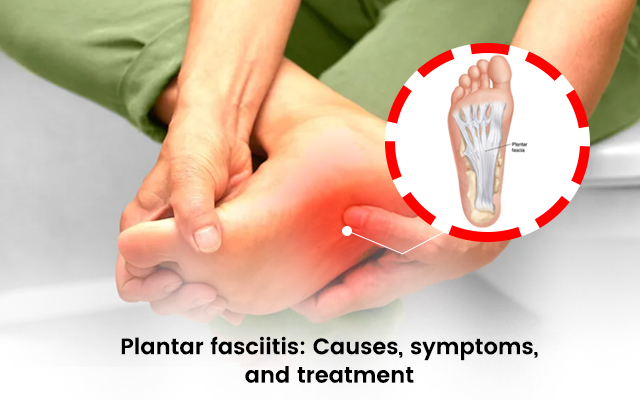 Plantar Fasciitis Causes And Symptoms Plantar Fasciitis Symptoms 