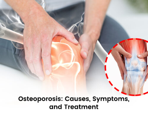 Osteoporosis: Causes, Symptoms, and Treatment Explain Orthopedic Clinic