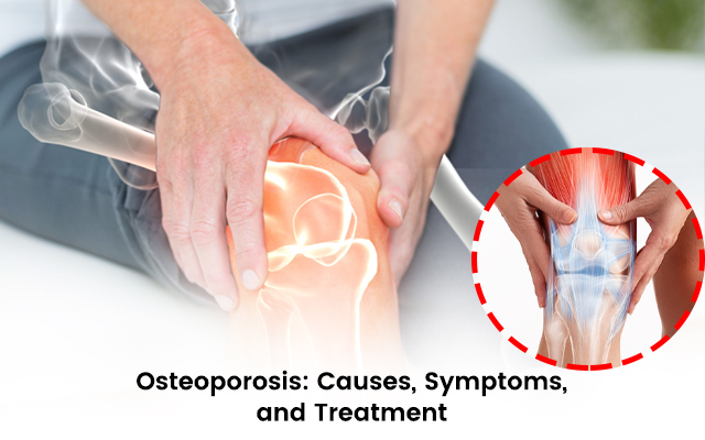 Osteoporosis symptoms and Treatment