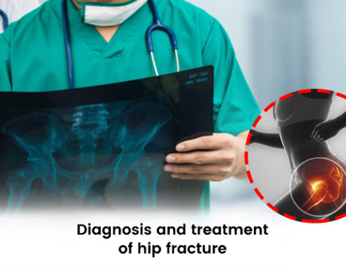 Diagnosis and Treatment of Hip Fracture