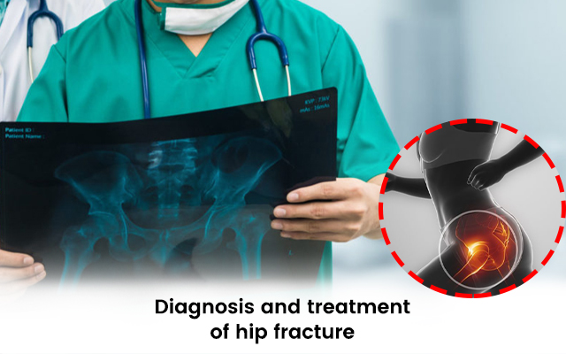 Hip Fracture Diagnosis & Treatment