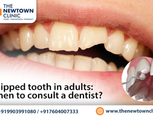 Chipped Tooth in Adults: When to Consult a Dentist?