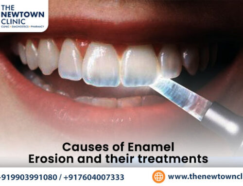 Causes of Enamel Erosion and Their Treatments
