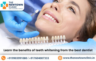 Learn the benefits of teeth whitening from the best dentist