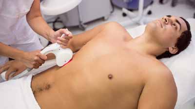 Laser-Hair-Removal-img