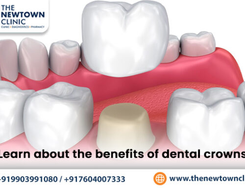 Learn about the benefits of dental crowns