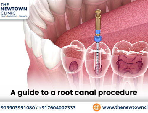 A guide to a root canal procedure