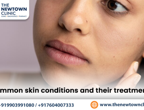 Common skin conditions and their treatments